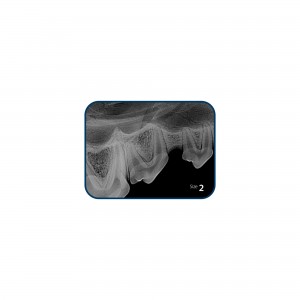 CR8 IMAGE PLATE IPX SIZE 2... 2