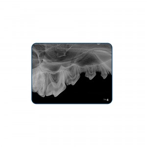 CR8 IMAGE PLATE IPX SIZE 4... 2